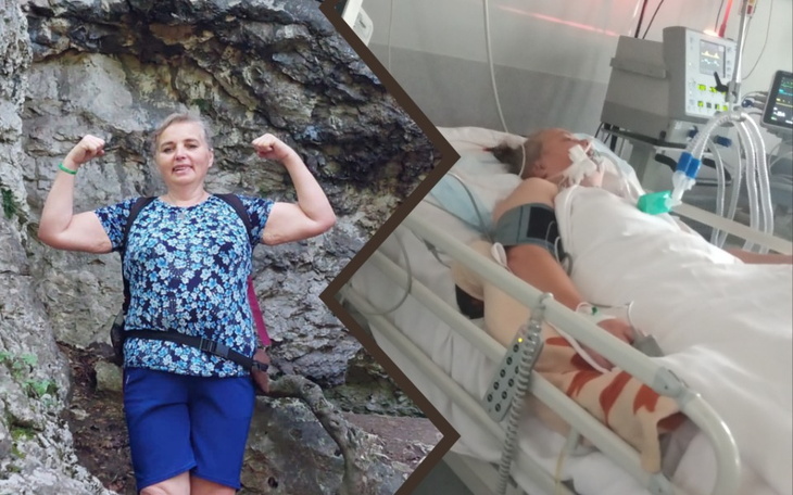 Zbiórka Walka Basi o sprawność po udarze - zdjęcie główne