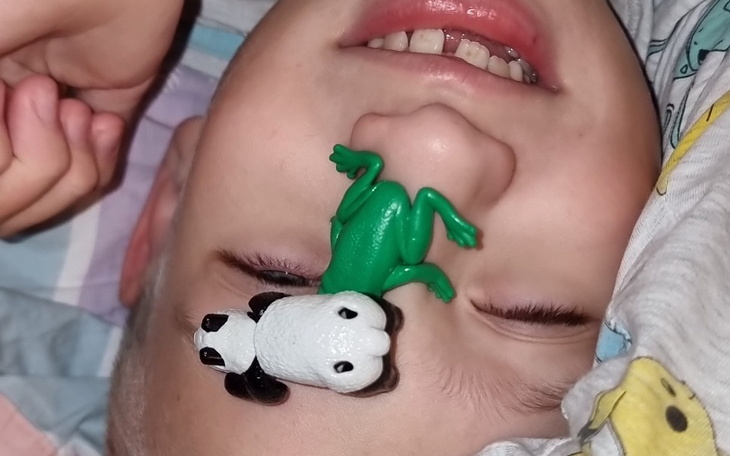 Zbiórka Operacja i rehabilitacja nóg Ale - zdjęcie główne