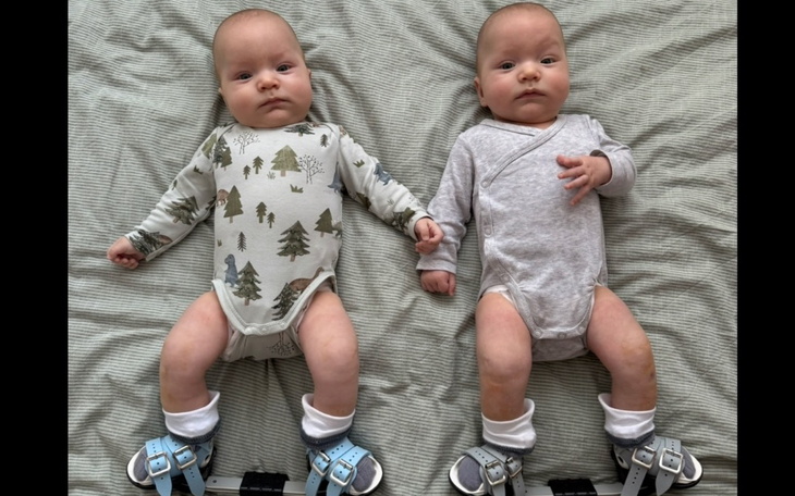 Dwa niemowlęta leżące obok siebie, ubrane w body.