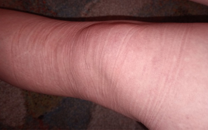 Zbiórka Na podstawowe życie codzienne - zdjęcie główne