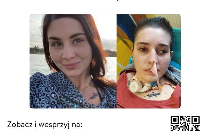 Zbiórka Rehabilitacja Ewa - zdjęcie główne