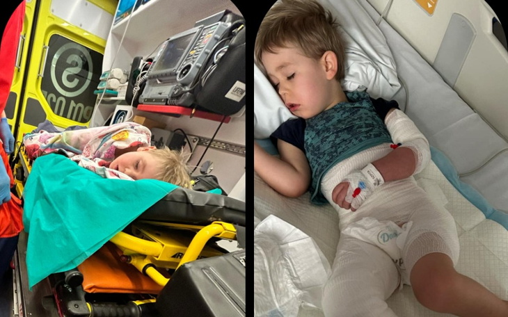 Dwoje dzieci śpiących w karetce, z widocznymi opatrunkami.