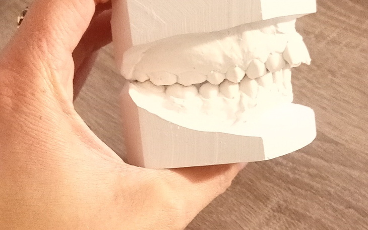 Model zębów trzymany w dłoni, przedstawiający szczegóły.