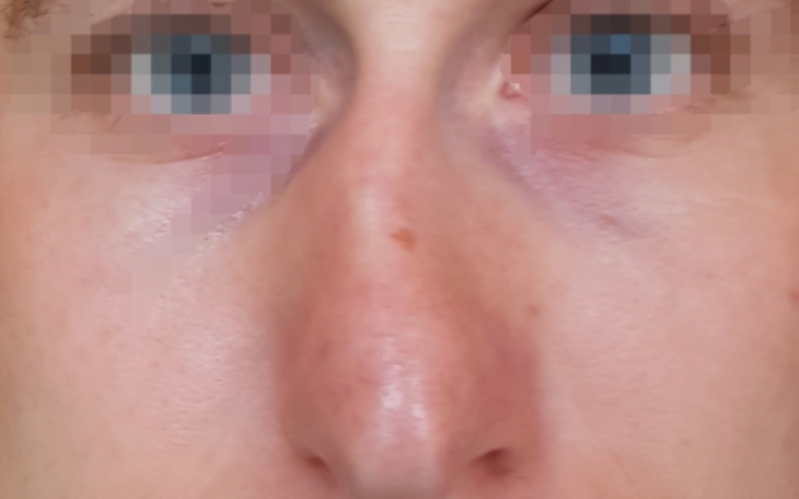 Zbiórka Operacja po urazie - zdjęcie główne