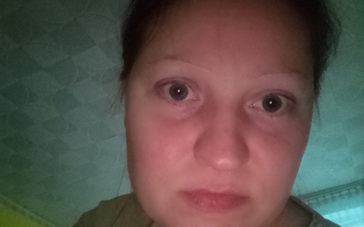 Zbiórka Rehabilitacja dla dla Kasi - zdjęcie główne