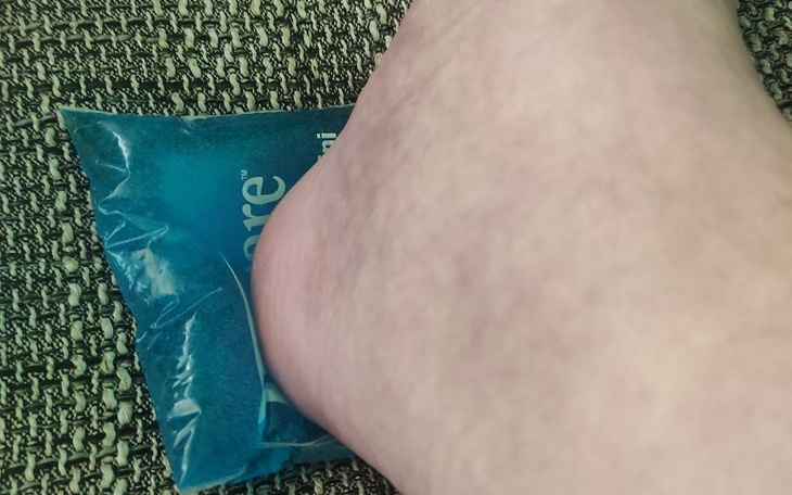 Zbiórka Operacja kości skokowej i stopy - zdjęcie główne