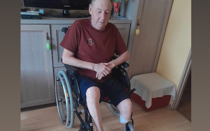 Zbiórka Dla kolegi na protze nogi - zdjęcie główne