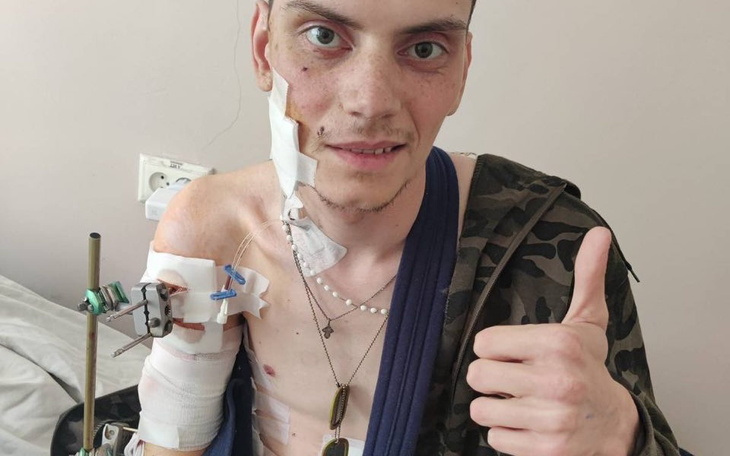 Zbiórka Uratuj rękę Pawłowi - zdjęcie główne