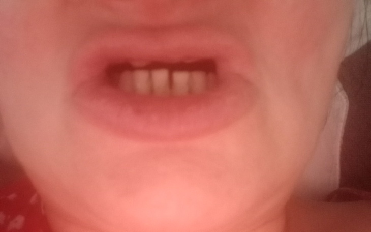 Zbiórka Nowy uśmiech dla Magdy - zdjęcie główne