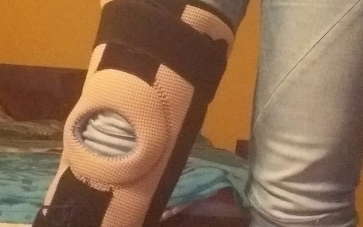 Zbiórka Na rechabilitacje - zdjęcie główne