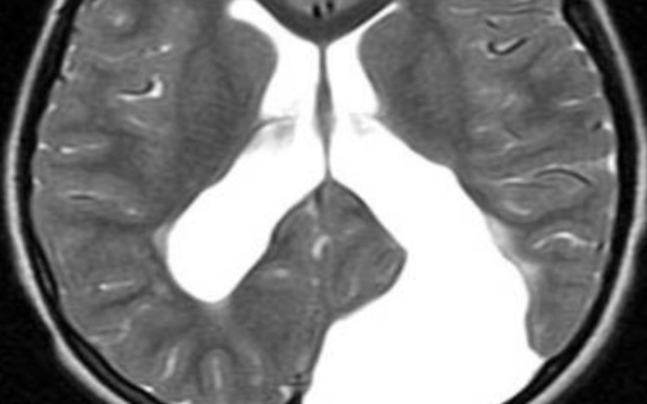 Zbiórka Na moją operację torbiela - zdjęcie główne