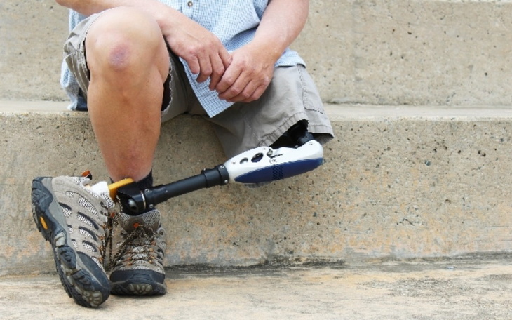 Zbiórka Na protezę nogi, powrót do życia - zdjęcie główne