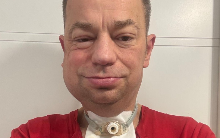 Chłopiec z rakiem, pozujący z maskotką w szpitalu.