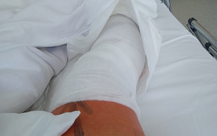 Zbiórka Rehabilitacja pooperacyjna.. - zdjęcie główne