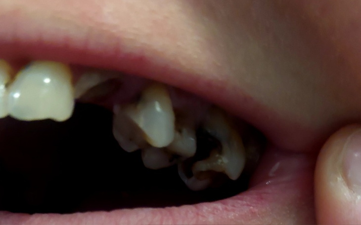 Zbiórka Na dentyste i nowy uśmiech - zdjęcie główne