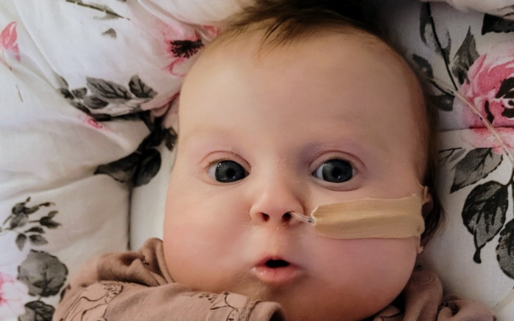 Małe dziecko z rurką do karmienia.