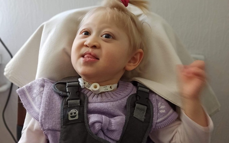 Mała dziewczynka z uśmiechem, nosząca specjalny sprzęt medyczny.