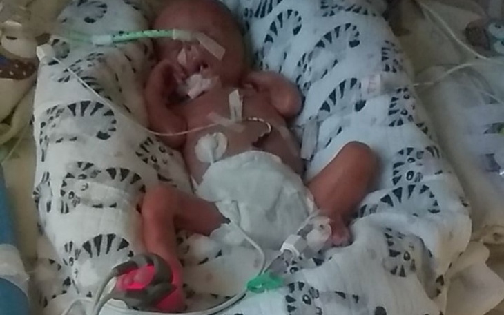 Noworodek w inkubatorze, podłączony do aparatury medycznej.