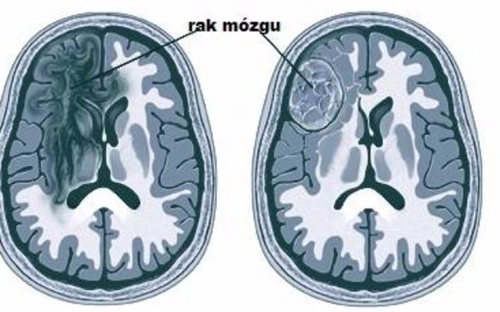 Zbiórka Dla dzieci z rakiem(Yasuo) - zdjęcie główne