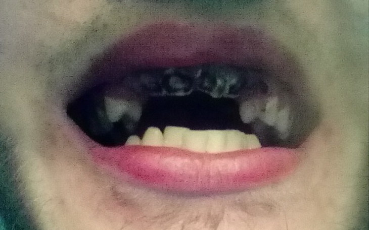 Zbiórka Leczenie chorych zębów - zdjęcie główne