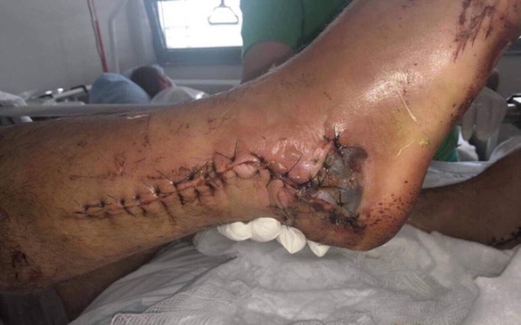 Zbiórka Rehabilitacja dla taty - zdjęcie główne