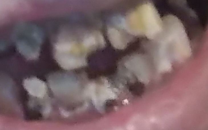 Zbiórka Marzenie o uśmiech - zdjęcie główne