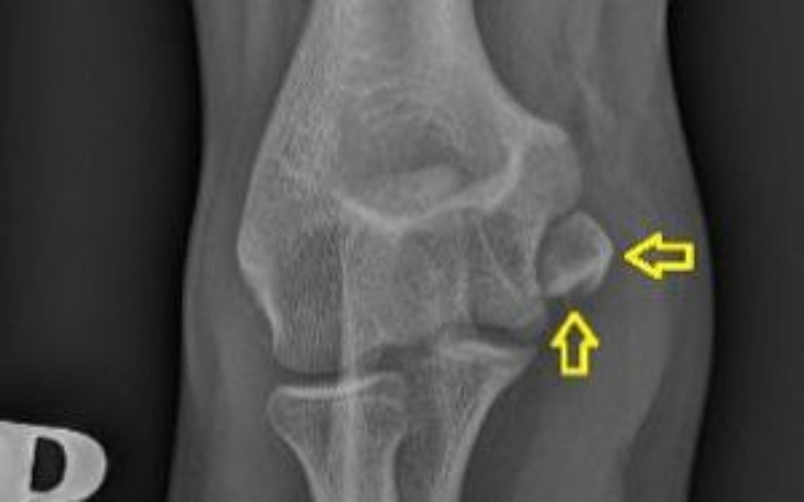 Zbiórka Operacja,leczenie kolana - zdjęcie główne