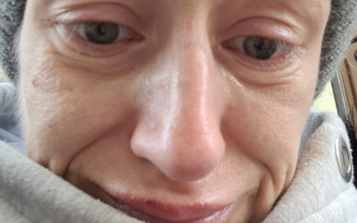 Zbliżenie na twarz osoby z wyrazem smutku.