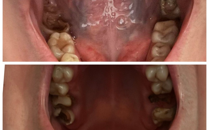 Zbiórka Leczenie zębów Yulii - zdjęcie główne