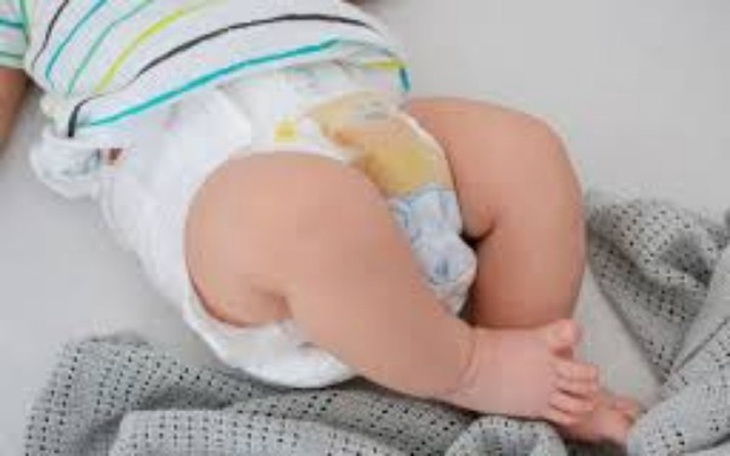 Zbiórka Pieluszka dla Maluszka - zdjęcie główne