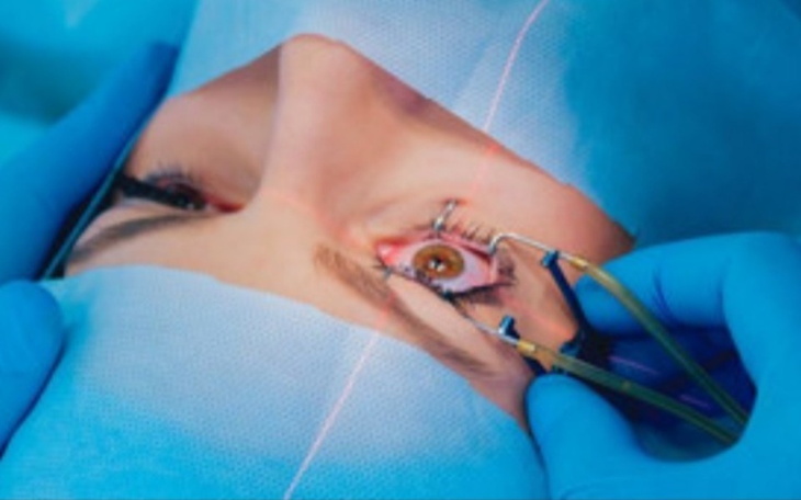 Zbiórka Laserowa operacja wzroku. - zdjęcie główne