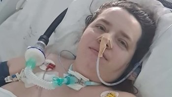 Zbiórka Na rehabilitację dla Eweliny - miniaturka zdjęcia