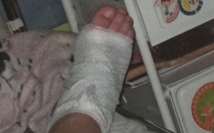 Zbiórka Pilna operacja stopy prawej - zdjęcie główne