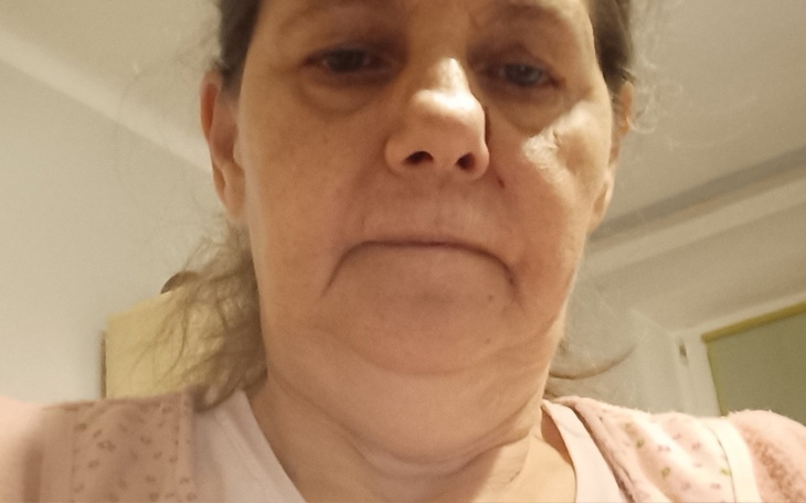 Zbiórka Pogorszenie SM - zdjęcie główne