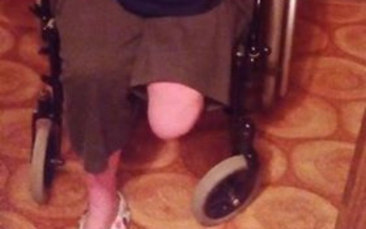 Zbiórka Pomozmy jej stanc na nogi - zdjęcie główne