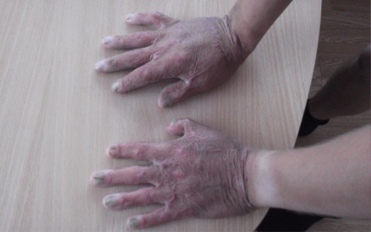 Zbiórka Na Nowe Ręce - zdjęcie główne