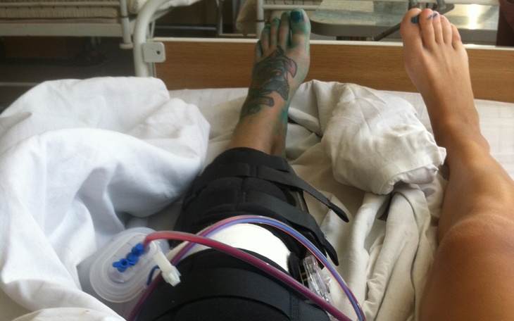 Zbiórka moje nowe kolano - zdjęcie główne