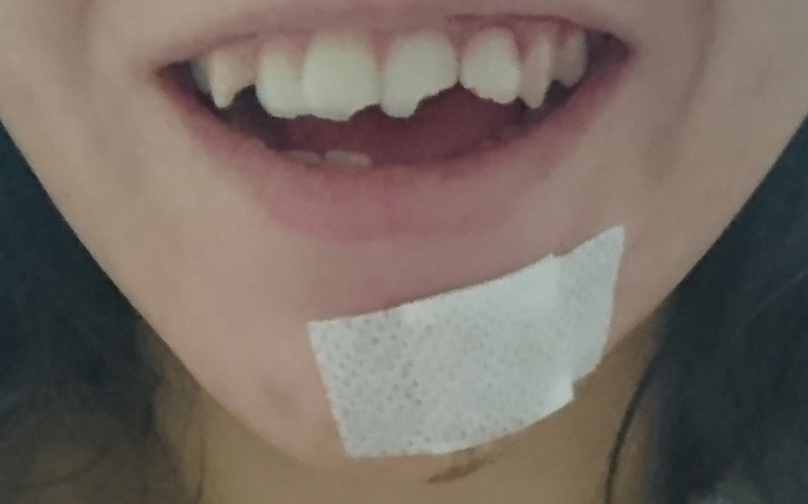 Zbiórka Uzupełnienie środków leczenia - zdjęcie główne