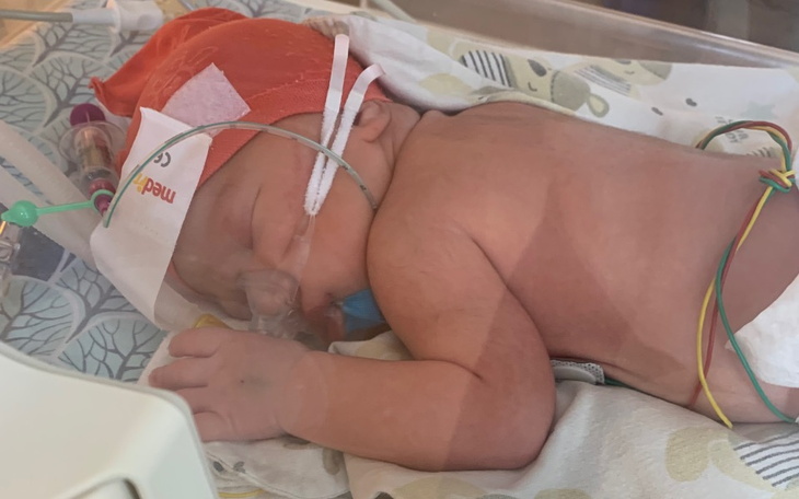 Zbiórka Grosik do groszeczka dla Frania - zdjęcie główne