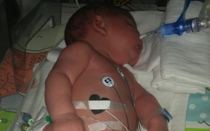 Zbiórka Pomoc dla Fabiana - zdjęcie główne