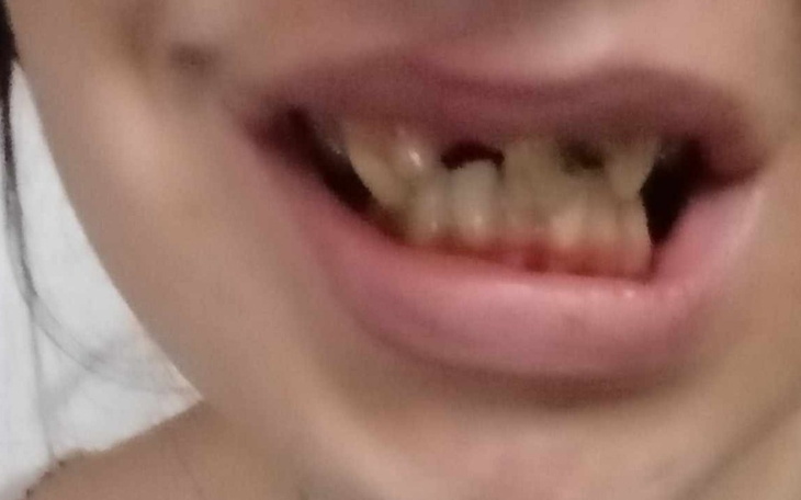 Zbiórka Brakuje mi uśmiechu pomożesz - zdjęcie główne