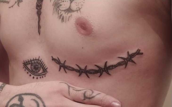 Zbiórka Korekta płci dla fela - zdjęcie główne