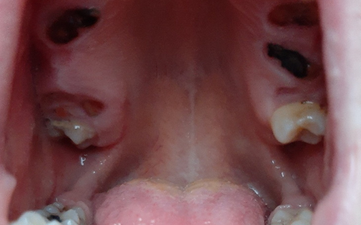 Zbiórka Na nowe zęby i lepsze życie - zdjęcie główne