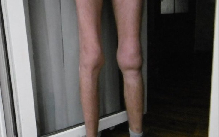 Zbiórka rehabilitacja operacja - zdjęcie główne