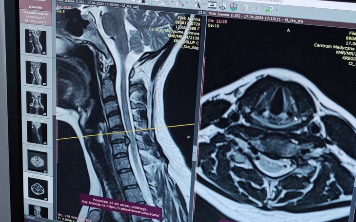 Zbiórka Joanna - Operacja kręgosłupa - zdjęcie główne