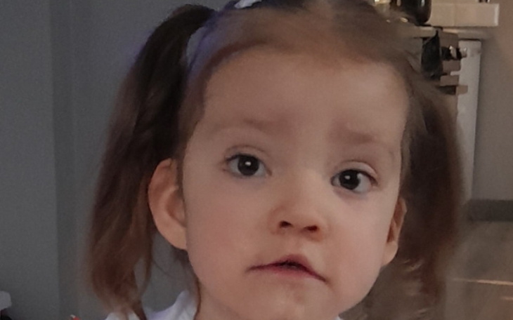 Mała dziewczynka z wyrazem zdziwienia na twarzy.