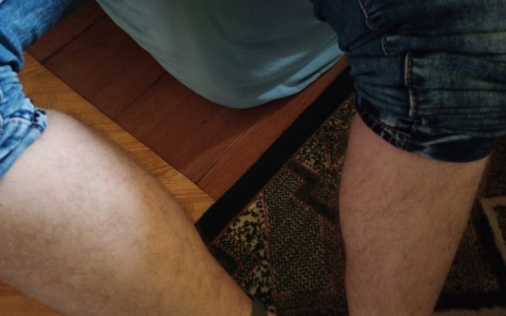 Zbiórka Rechabilitacja miesnia - zdjęcie główne