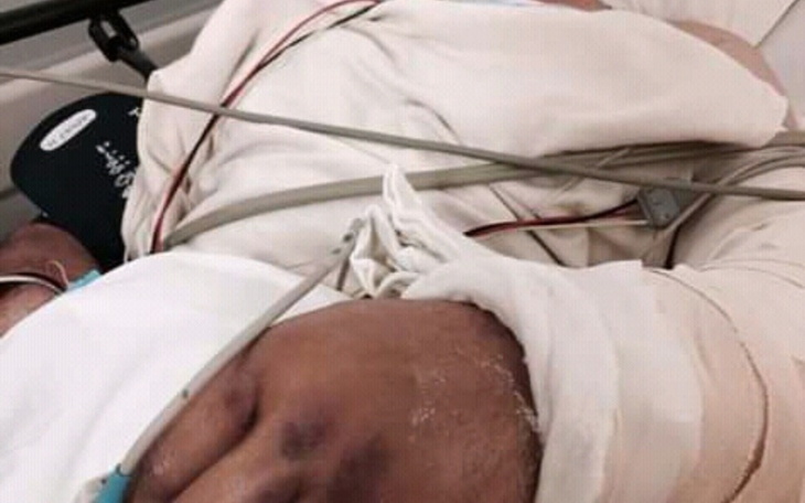 Zbiórka Zbiórka na leki dla kolegi po wy - zdjęcie główne