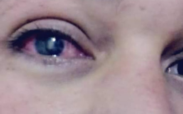 Zbiórka Uratować oczy - zdjęcie główne