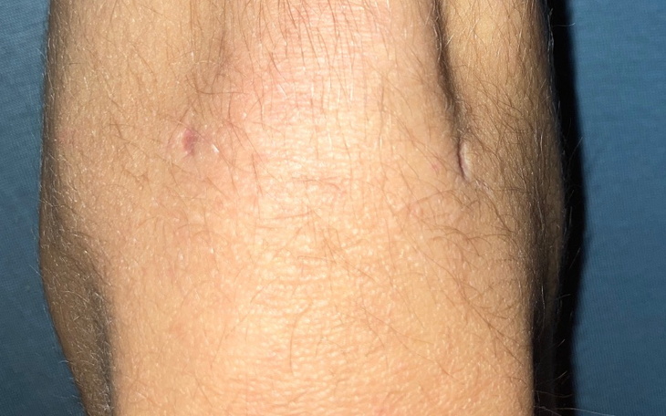 Zbiórka na artroskopie kolana - zdjęcie główne